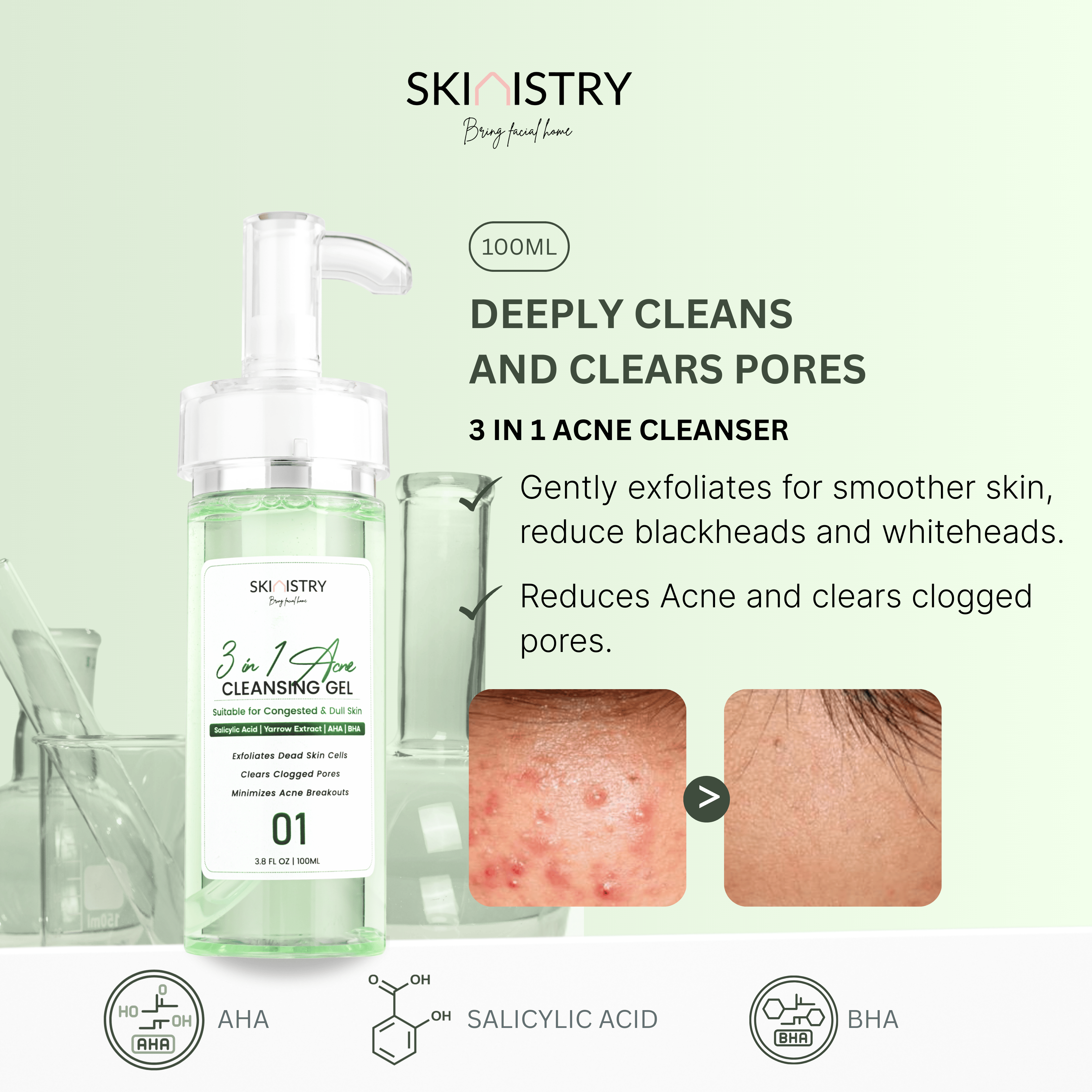 3 in 1 Acne Cleanser (100ml)